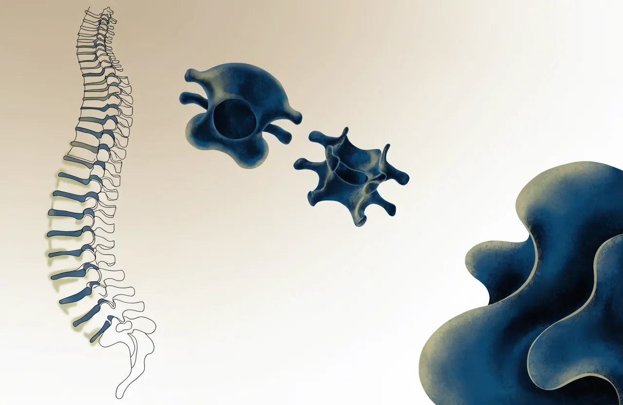 Neurocirurgia — imagem conceitual